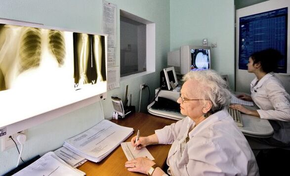 Radiografías para diagnosticar el dolor de espalda