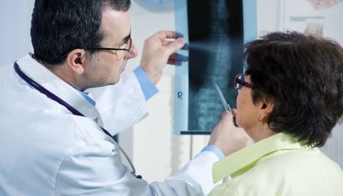 radiografía de la columna vertebral con osteocondrosis