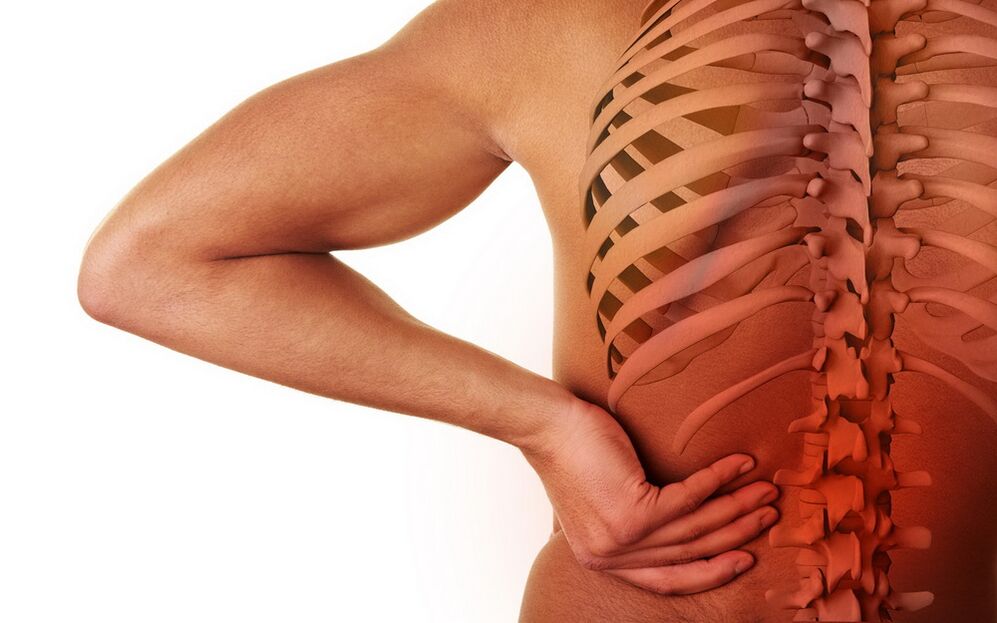dolor de espalda debido a la osteocondrosis