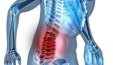 Signos y síntomas de osteocondrosis lumbar