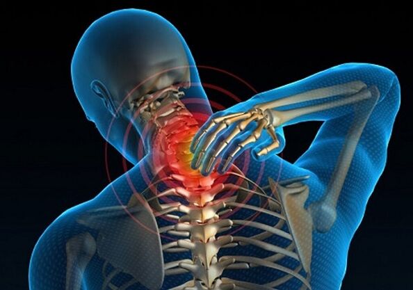 dolor de cuello debido a la osteocondrosis