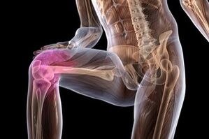 Dolor en las articulaciones debido a artrosis de rodilla.